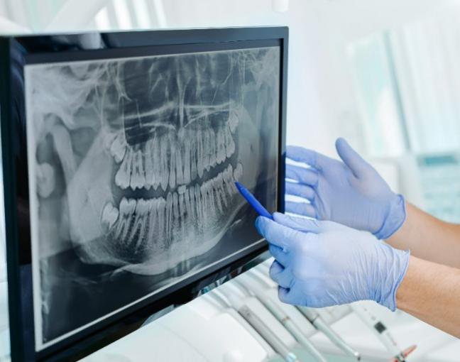Dental Office Brussels Dental Office Brussels